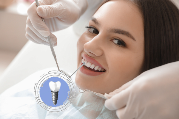 How To Protect Your Dental Implants