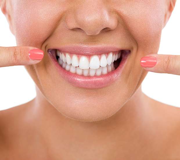 Fort Worth What Is Gum Contouring & Reshaping