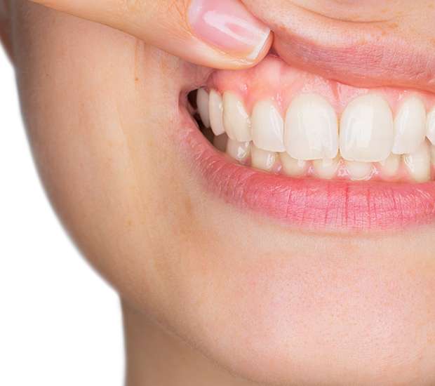 Fort Worth Gum Disease