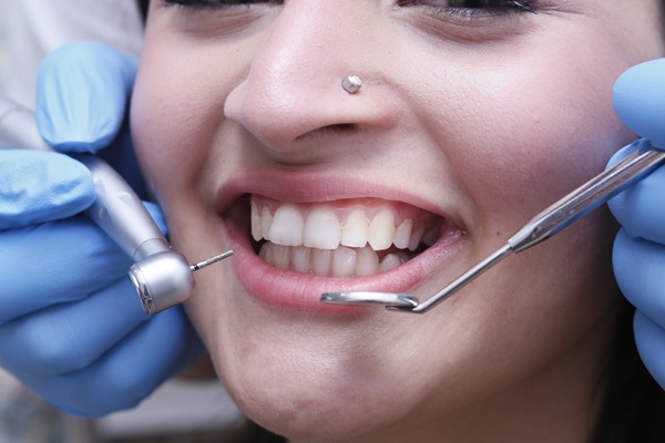 Making A Custom Smile Makeover Plan With Your Cosmetic Dentist