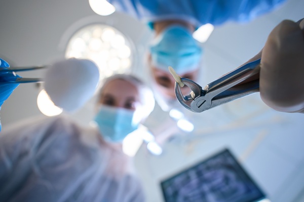 Benefits Of A Tooth Extraction